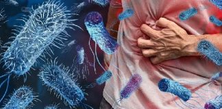 40 ألف حالة.. لبنان تحت وطأة الكوليرا