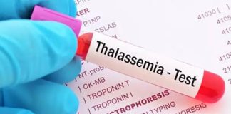 في يومه العالمي… ما هو مرض الثلاسيميا؟
