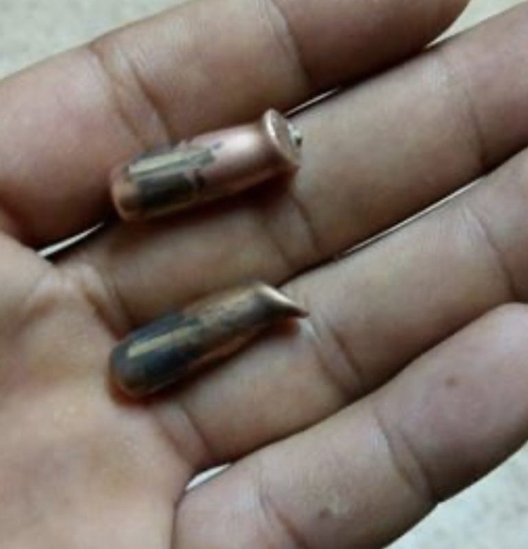 *إصابة قاصر بطلق ناري عن طريق الخطأ في طرابلس*